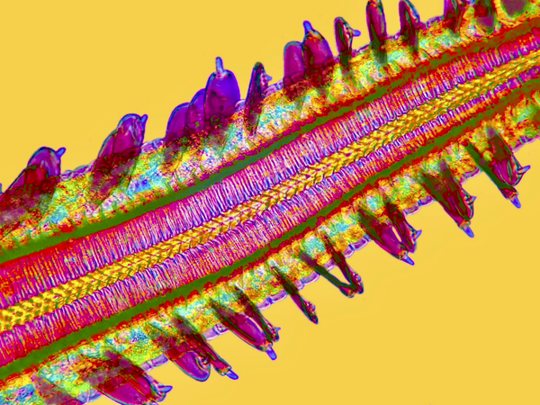 Tip of a butterfly tongue. Dr. Stephen S. Nagy. Montana, USA. 750x.  Butterflies have chemoreceptors, or nerve cells that open onto the surface of their exoskeleton & react to the presence of different chemicals